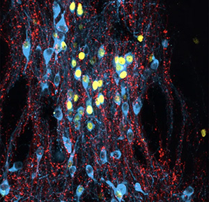[Архэ] Сергей Лопатин ― Биология стресса. Лекция 2: Как справиться со стрессором? (2024)